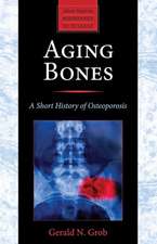 Aging Bones – A Short History of Osteoporosis