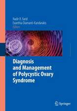 Diagnosis and Management of Polycystic Ovary Syndrome