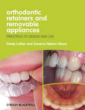 Orthodontic Retainers and Removable Appliances – Principles of Design and Use