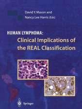 Human Lymphoma: Clinical Implications of the REAL Classification