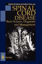 Spinal Cord Disease: Basic Science, Diagnosis and Management