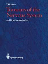 Tumours of the Nervous System: an Ultrastructural Atlas