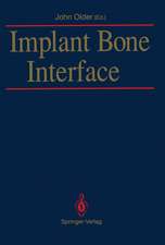 Implant Bone Interface