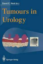 Tumours in Urology