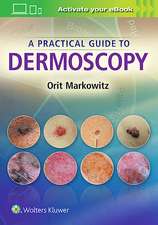 Markowitz, O: Practical Guide to Dermoscopy
