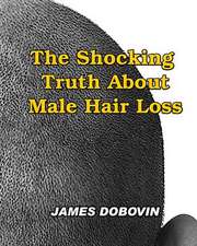 The Shocking Truth about Male Hair Loss