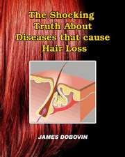 The Shocking Truth about Diseases That Cause Hair Loss