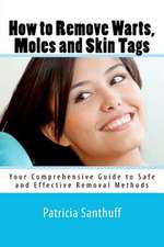 How to Remove Warts, Moles and Skin Tags