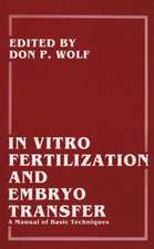 In Vitro Fertilization and Embryo Transfer: A Manual of Basic Techniques