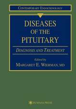 Diseases of the Pituitary: Diagnosis and Treatment