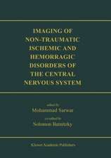 Imaging of Non-Traumatic Ischemic and Hemorrhagic Disorders of the Central Nervous System