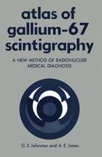 Atlas of Gallium-67 Scintigraphy: A New Method of Radionuclide Medical Diagnosis