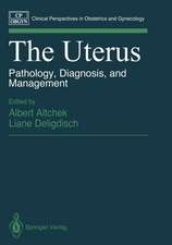 The Uterus: Pathology, Diagnosis, and Management