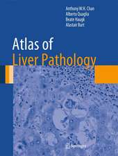 Atlas of Liver Pathology