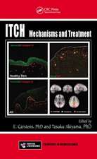 Itch: Mechanisms and Treatment