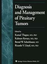 Diagnosis and Management of Pituitary Tumors