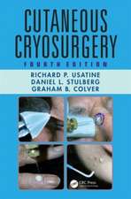 Cutaneous Cryosurgery