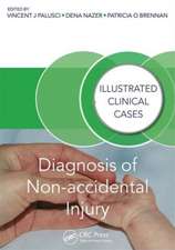 Diagnosis of Non-accidental Injury: Illustrated Clinical Cases