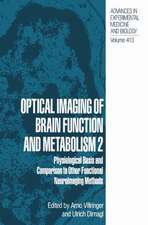 Optical Imaging of Brain Function and Metabolism 2: Physiological Basis and Comparison to Other Functional Neuroimaging Methods