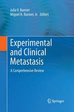 Experimental and Clinical Metastasis: A Comprehensive Review