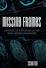Missing Frames