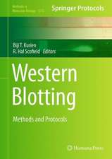 Western Blotting: Methods and Protocols