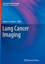 Lung Cancer Imaging