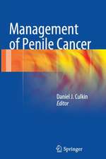 Management of Penile Cancer