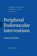 Peripheral Endovascular Interventions