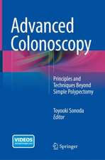 Advanced Colonoscopy: Principles and Techniques Beyond Simple Polypectomy