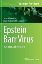 Epstein Barr Virus: Methods and Protocols