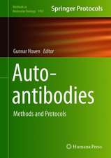 Autoantibodies: Methods and Protocols