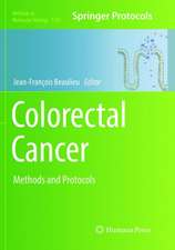 Colorectal Cancer: Methods and Protocols