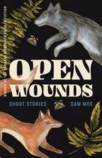 Open Wounds: Short Stories