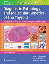 Diagnostic Pathology and Molecular Genetics of the Thyroid: A Comprehensive Guide for Practicing Thyroid Pathology