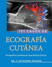 101 Casos de Ecografia Cutanea