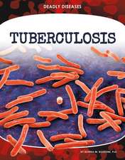 Bozzone, D: Tuberculosis
