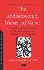 Rediscovered Tricuspid Valve