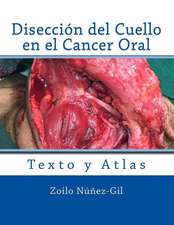 Diseccion del Cuello En El Cancer Oral