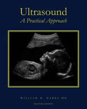 Ultrasound