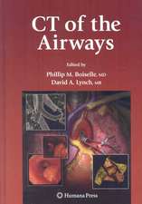 CT of the Airways