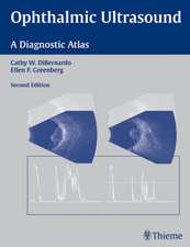 Ophthalmic Ultrasound – A Diagnostic Atlas