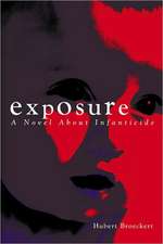 Exposure