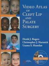 Video Atlas of Cleft Lip and Palate Surgery