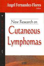 New Research on Cutaneous Lymphomas