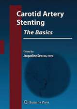 Carotid Artery Stenting: The Basics