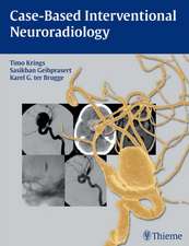 Case-Based Interventional Neuroradiology