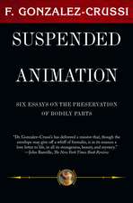 Suspended Animation: Six Essays on the Preservation of Bodily Parts