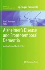 Alzheimer's Disease and Frontotemporal Dementia: Methods and Protocols