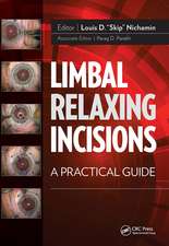 Limbal Relaxing Incisions: A Practical Guide